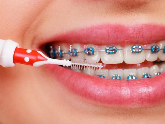 Mieszkańcy Białołęki już wiedzą, gdzie leczyć zęby. A Ty? Mieszkańcy Białołęki już wiedzą, gdzie leczyć zęby. A Ty?